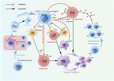 Bone marrow immune cells and drug resistance in acute myeloid leukemia